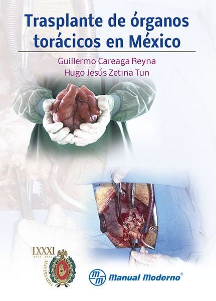 Careaga Reyna Gullermo. Trasplante de órganos torácicos en México. 1a ed. 2014