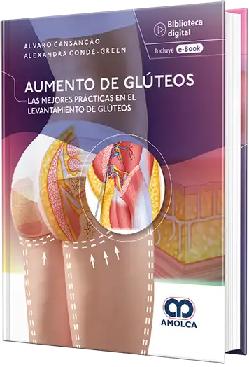 Alvaro Casancao. Aumento de glúteos. Las mejores prácticas en el levantamiento de glúteos. 1ra ed. 2024. ¡¡¡NOVEDAD,NOVEDAD,NOVEDAD!!!