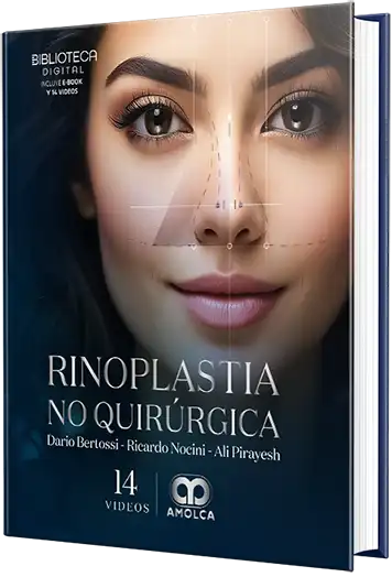 DARIO BERTOSSI. Rinoplastia no quirúrgica. 1a ed. 2024