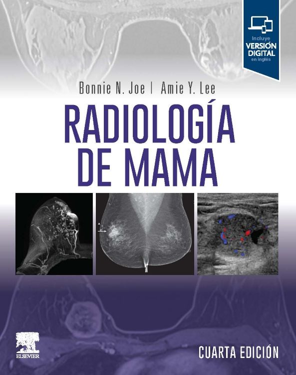 Joe N. Bonnie. Radiología de Mama. 4a ed. 2024