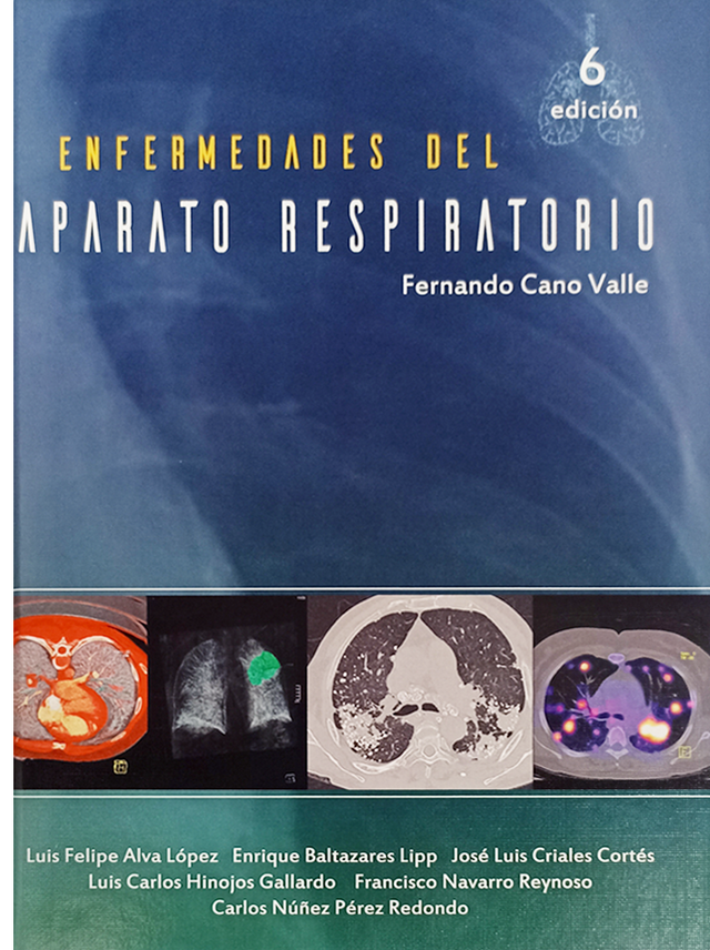 Cano Valle Fernando. Enfermedades del Aparato Respiratorio. 6a ed. 2023