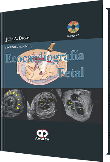 Julia A. Drose. Ecocardiografía Fetal 2a ed. 2011