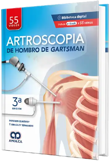 Hussein Elkousy. Artroscopia de Hombro de Gartsman. 1a ed. 2022