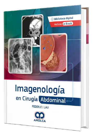 Michael P. Federle. Imagenología en Cirugía Abdominal. 1a ed. 2022