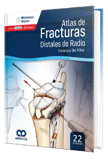 Francisco Del Villa. Atlas de Fracturas Distales de Radio. 1ra ed. 2022