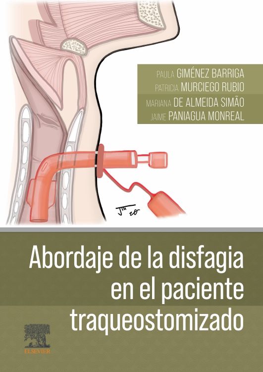 Giménez Barriga Paula. Abordaje de la Disfagia en el Paciente Traqueostomizado. 1a ed. 2024