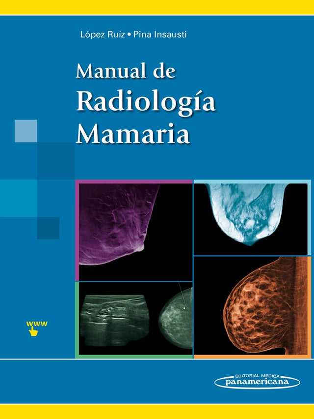 Jose Antonio López Ruiz. Manual de Radiología Mamaria. 1a ed. 2016.