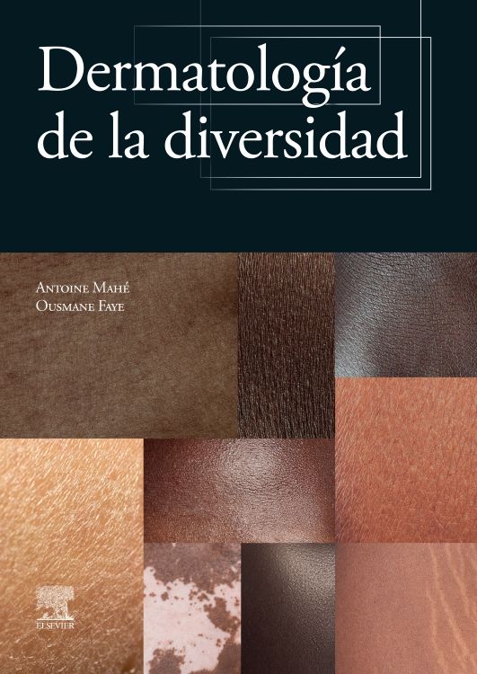 Mahé Antoine. Dermatología de la Diversidad. 1a ed. 2024