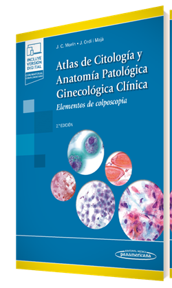Juan Carlos Morin Gamarra. Atlas de Citología y Anatomía Patológica Ginecológica Clínica. 2a ed. 2023