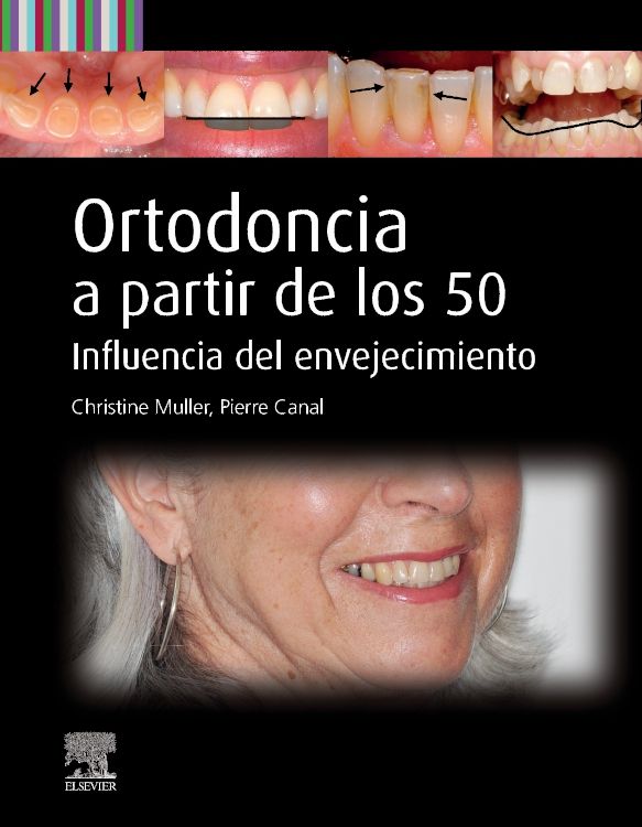Muller Christine. Ortodoncia a Partir de los 50. Influencia del Envejecimiento. 1a ed. 2025
