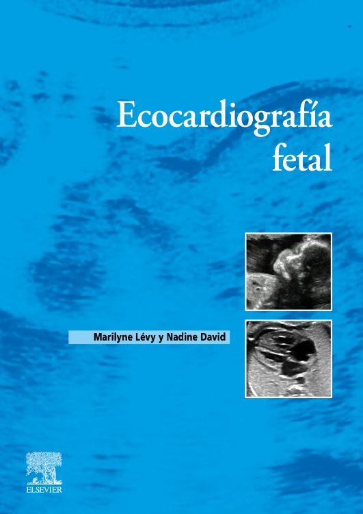 Maryline Lévy. Ecocardiografía fetal. 1a. ed.2023