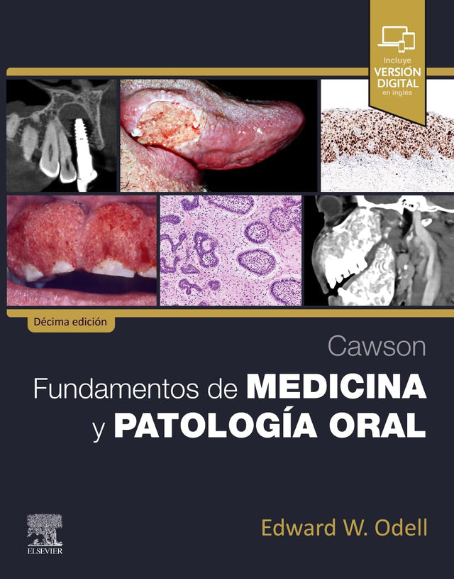 Edward W. Odell. Cawson. Fundamentos de medicina y patología oral. 10a ed. 2025