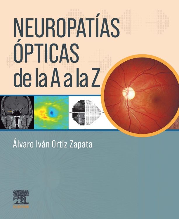 Ortiz Zapata. Álvaro Iván. Neuropatías ópticas de la A a la Z. 1a ed. 2024