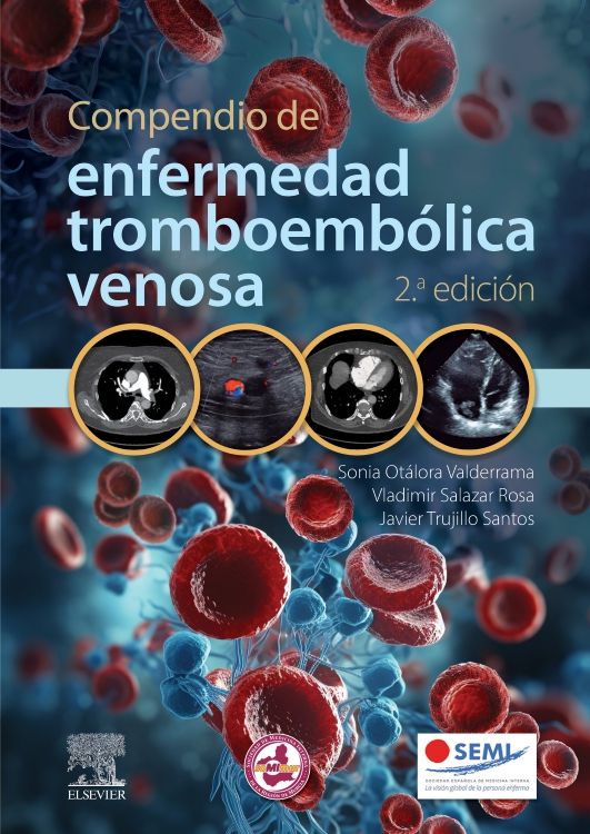 Otálora Valderrama. Sonia del Pilar. Compendio de enfermedad tromboembólica venosa. 2da ed. 2024