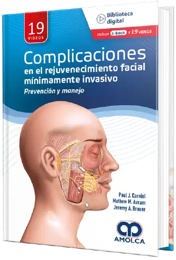 Paul J Carniol. MD. Complicaciones en el rejuvenecimiento facial mínimamente invasivo - Prevención y manejo. 1ra ed. 2022