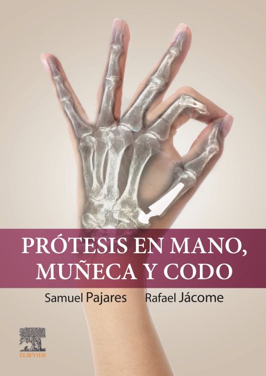 Pajares Cabanillas. Samuel.Prótesis en mano, muñeca y codo. 1a ed. 2024