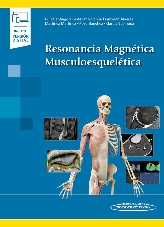 Ruiz Santiago Fernando. Resonancia Magnética Musculoesquelética. 1a ed. 2024 ¡¡¡NOVEDAD, NOVEDAD, NOVEDAD!!!
