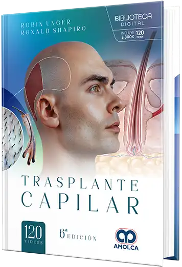 Robin Uger. Trasplante capilar. 6.a ed. 2025