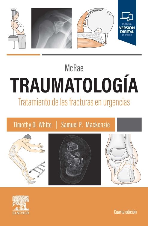 White Timothy O. White.McRae. Traumatología. Tratamiento de las Fracturas en Urgencias. 4a ed. 2024