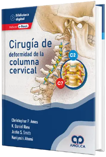 Christopher P. Ames, MD. Cirugía de deformidad de la Columna Cervical 1ra ed. 2022