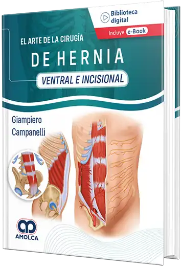 Giampiero Campanelli. El arte de la Cirugía de la Hernia - Ventral e Incisional. 1ra ed. 2022
