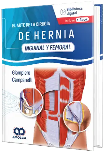 Giampiero Campanelli. El Arte de la Cirugía de la Hernia - Inguinal y Femoral. 1ra ed. 2022