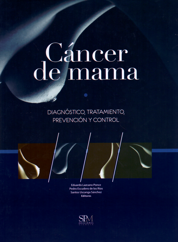 Lazcano Ponce. Eduardo Cáncer de mama 1ra edición 2014