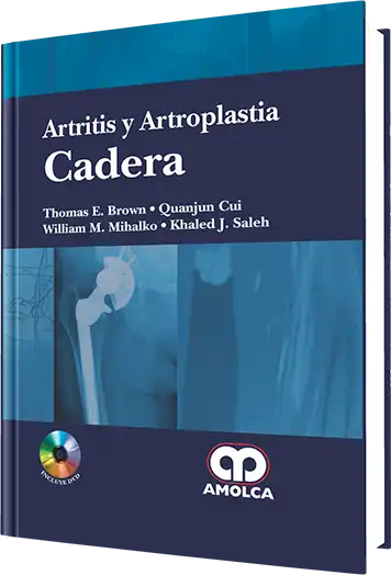 Thomas E. Brown. Artritis y Artroplastia. Cadera. 1ra ed. 2013