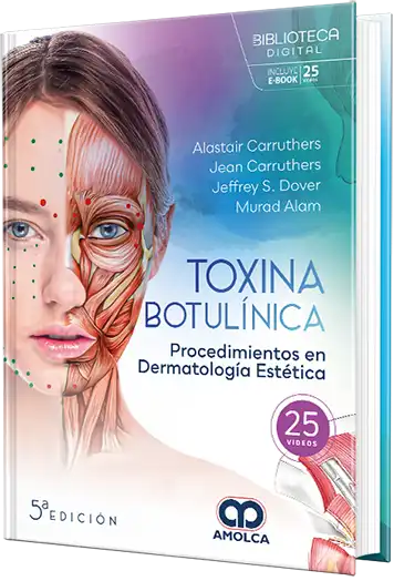 Alastair Carruthers y Jean Carruthers. Toxina botulínica. Procedimientos en dermatología estética. 1ra ed. 2024 ¡¡¡NOVEDAD,NOVEDAD,NOVEDAD!!!