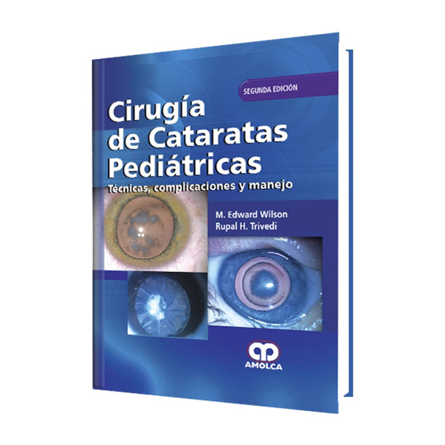 M. Edward Wilson Cirugía de Cataratas Pediátricas. Segunda Edición 2017
