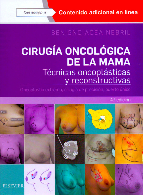 Acea Nebril, B., Cirugía oncológica de la mama 4 ed. © 2018