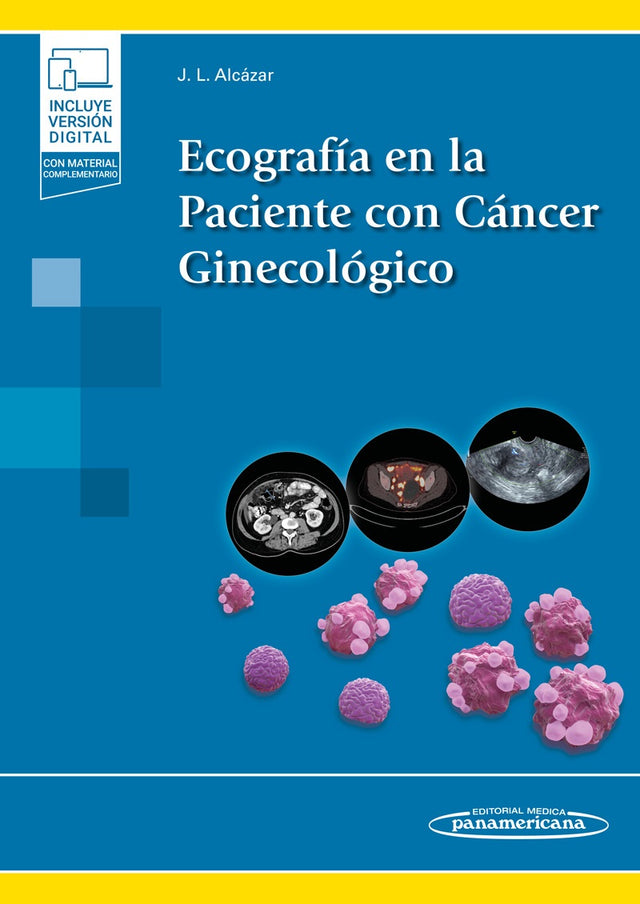 Alcázar Zambrano. Ecografía en la Paciente con Cáncer Ginecológico. 1a ed. 2022