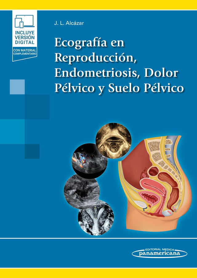Alcázar Zambrano. Ecografía en Reproducción, Endometriosis, Dolor Pélvico y Suelo Pélvico. 1a ed. 2022