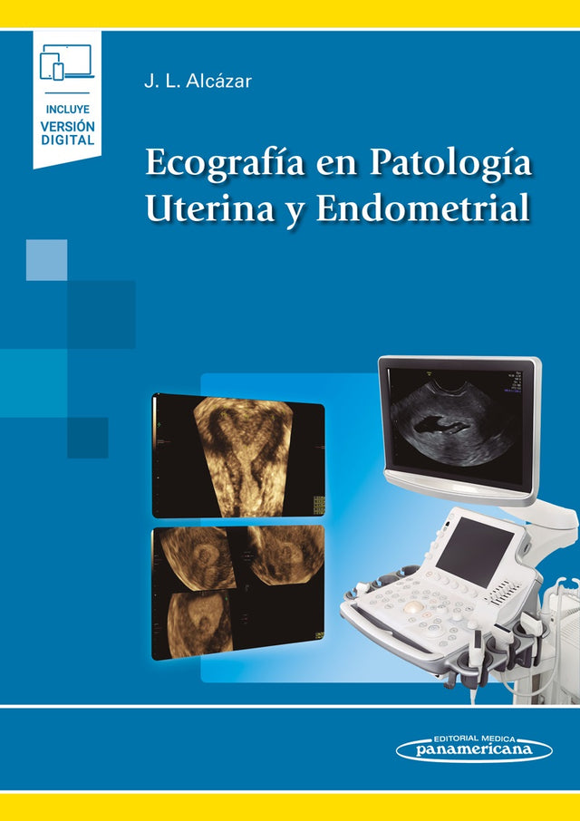 Alcázar Zambrano. Juan Luis. Ecografía en Patología Uterina y Endometrial. 1ra ed. 2021