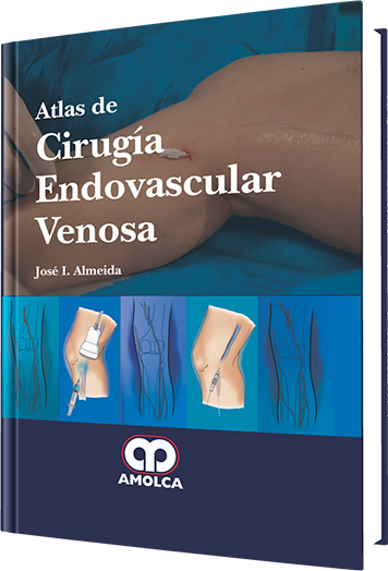 José L. Almeida. Atlas de Cirugía Endovascular Venosa. 1a. ed. 2013