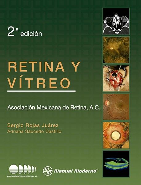 ASOCIACION MEXICANA DE RETINA. RETINA Y VITREO. 2a ed. 2012
