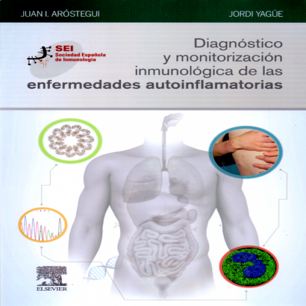Aróstegui Gorospe. J.I., Diagnóstico y monitorización inmunológica de las enfermedades autoinflamatorias 1a ed. © 2019