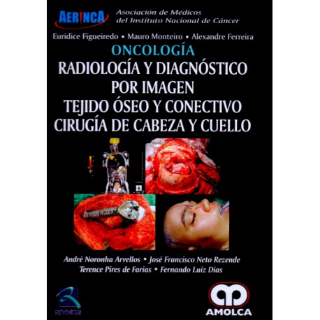 André Noronha Arvellos. Oncología , Radiología y DPI Tejido Óseo y Conectivo Cirugía de Cabeza y Cuello. 1ra ed. 2017