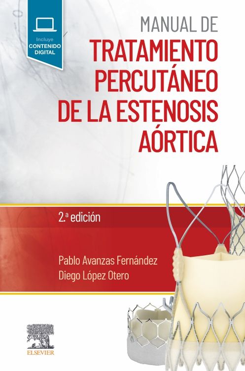 Avanzas. Manual de tratamiento percutáneo de la estenosis aórtica. 2a. ed. 2022