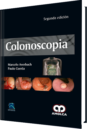 Marcelo Averbach. Colonoscopia. 2a. ed. 2017