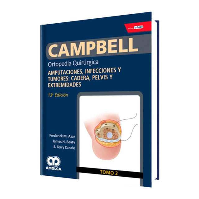 Frederick M. Azar. Ortopedia  Quirúrgica. Amputaciones, Infecciones y Tumores: Cadera, Pelvis y Extremidades. Incluye e-Book y Videos. 13a. ed. 2019