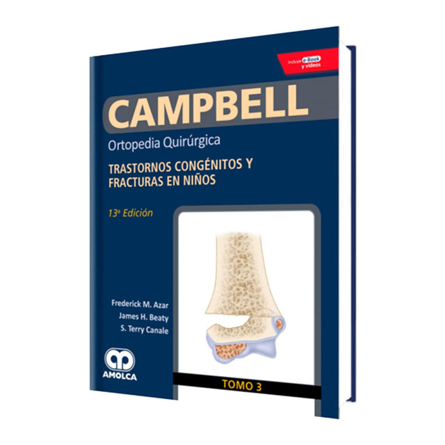 Frederick M. Azar. Ortopedia  Quirúrgica. Transtornos Congénitos y Fracturas en Niños. Incluye e-Book y Videos. 13a. ed. 2019