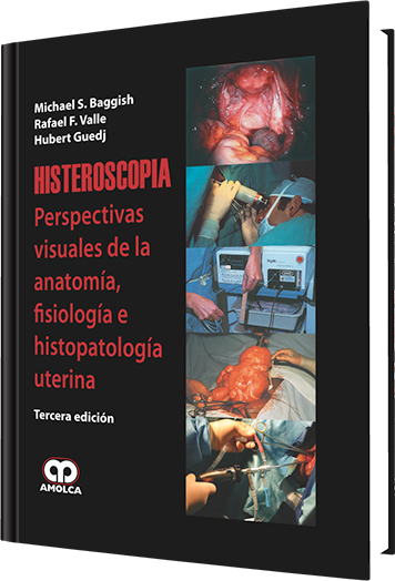 Michael S. Baggish. Histeroscopía. 3a. ed. 2009