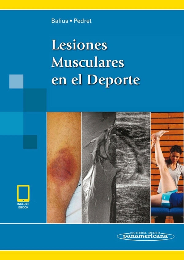 Balius Matas. Lesiones Musculares en el Deporte. 1a ed 2013