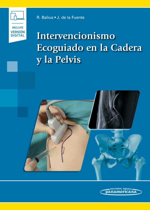 Balius Matas. Intervencionismo Ecoguiado en la Cadera y la Pelvis. 1a ed 2020