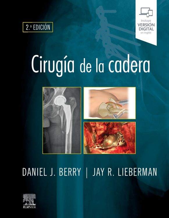 Berry, D. J., Cirugía de la cadera 2 ed. © 2021