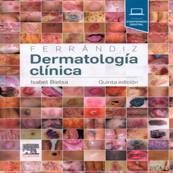 Bielsa, I., Ferrándiz. Dermatología clínica 5 ed. © 2019 R 2020