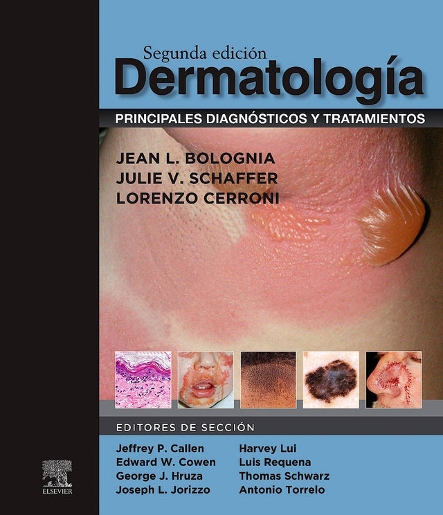 Bolognia L. Jean. Dermatología: principales diagnósticos y tratamientos. 2a. ed. 2023