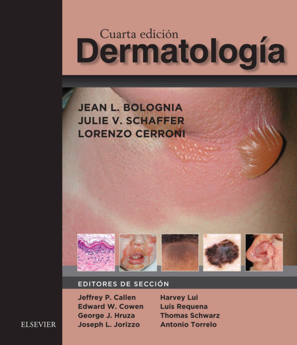 Bolognia, J.L., Bolognia. Dermatología 2 VOL. © 2018 R 2019