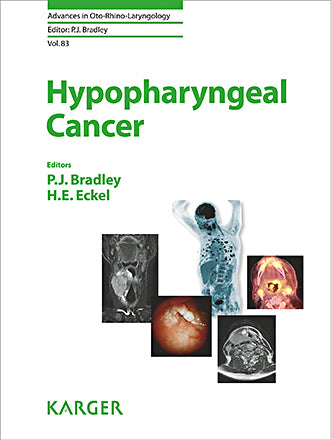 Bradley, Patrick J. (Nottingham). Hypopharyngeal Cancer. 2019
